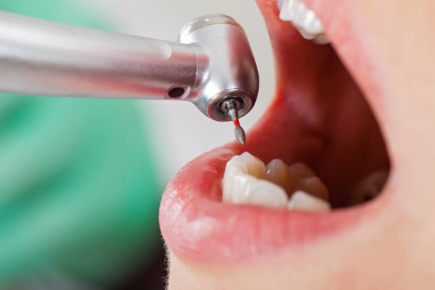 Best Broken or Chipped Tooth Repair in Las Palmas Ii, TX